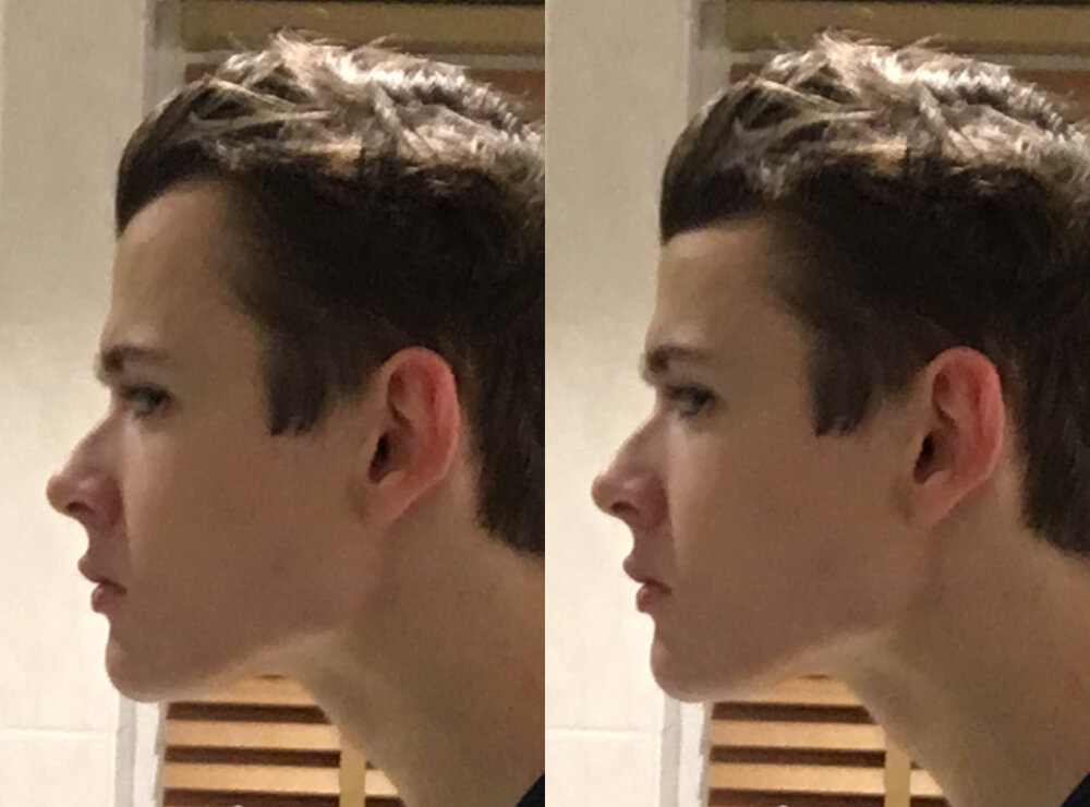 Sideprofilecomparison