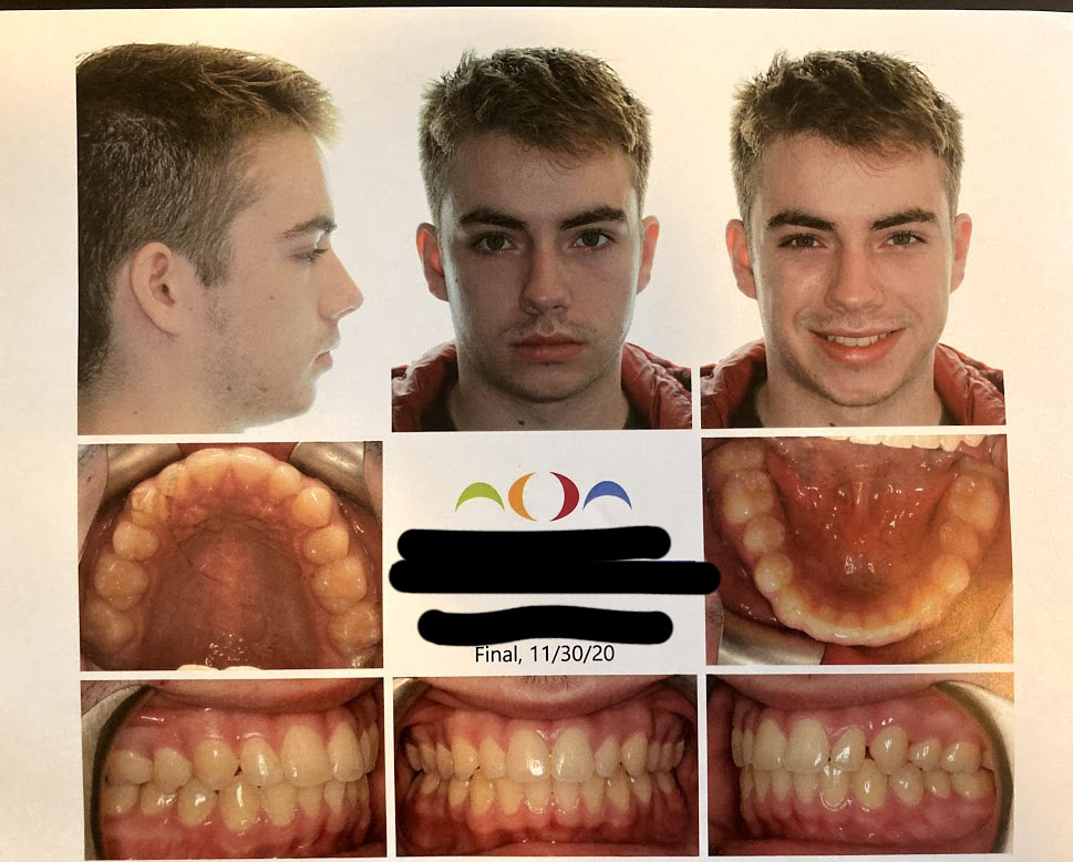 After photos
