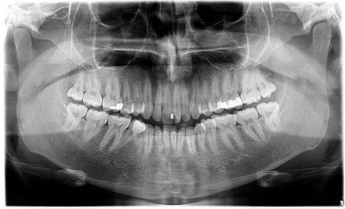 ctscan1.jpg