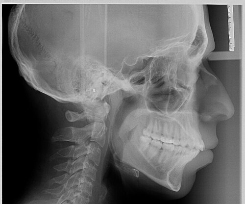 ctscan2.jpg