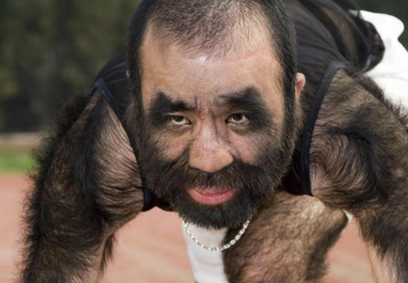 Hairiest