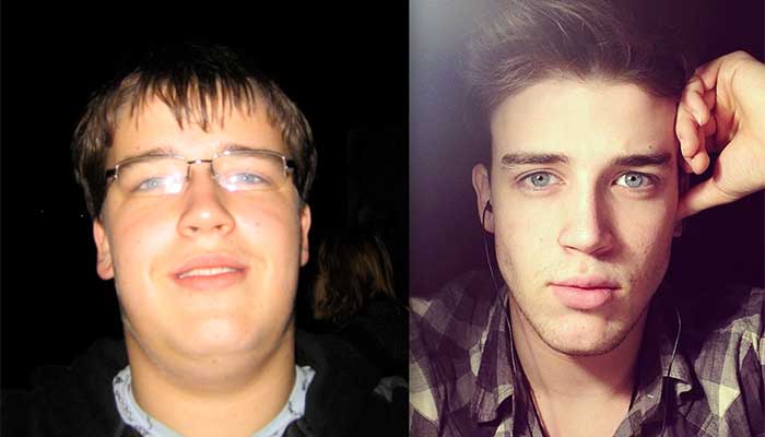 Face fat loss before and after