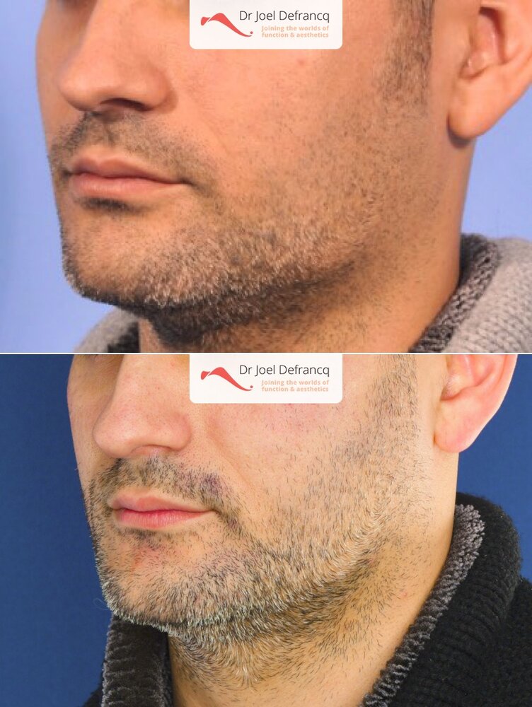 Dr Joel Defrancq 1533567629019348300 1737