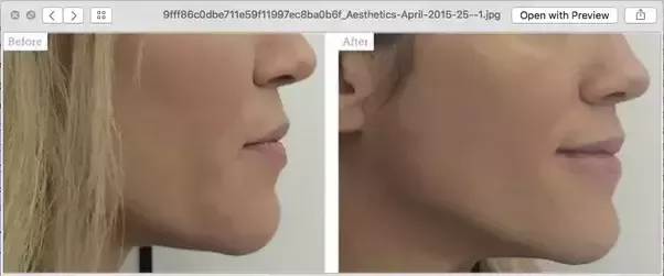 1606842925833