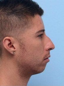 Jawline male 450x325