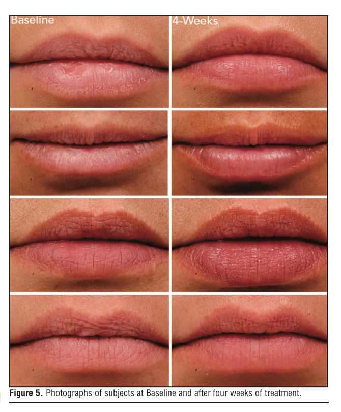 Captura de Tela 2020 12 08 as 104422