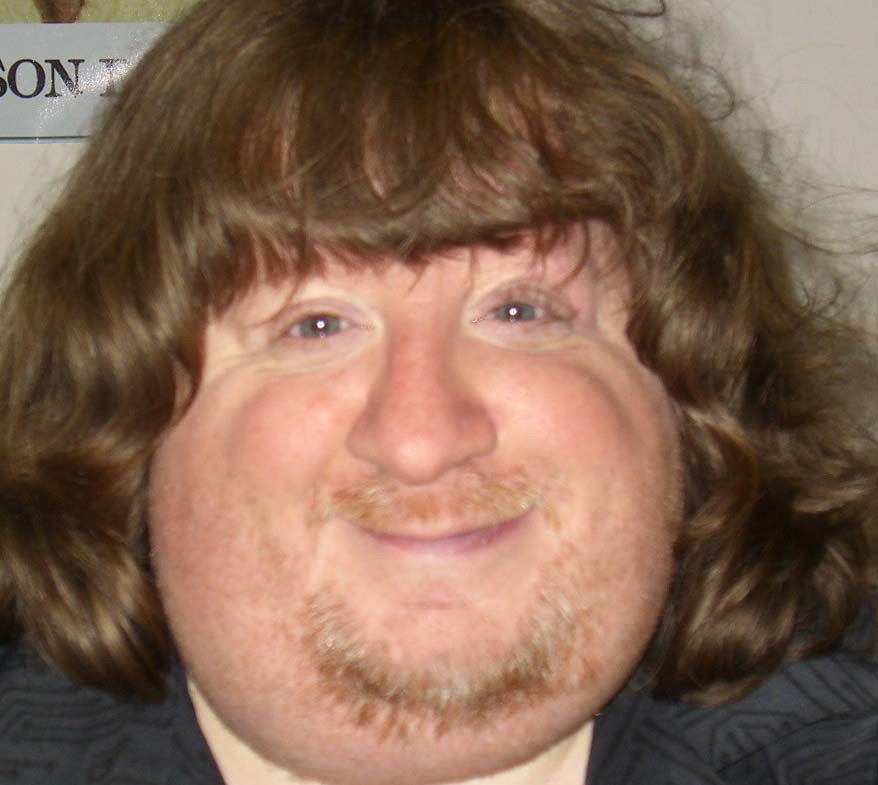 Who is the ugliest man in the world 1413417948597