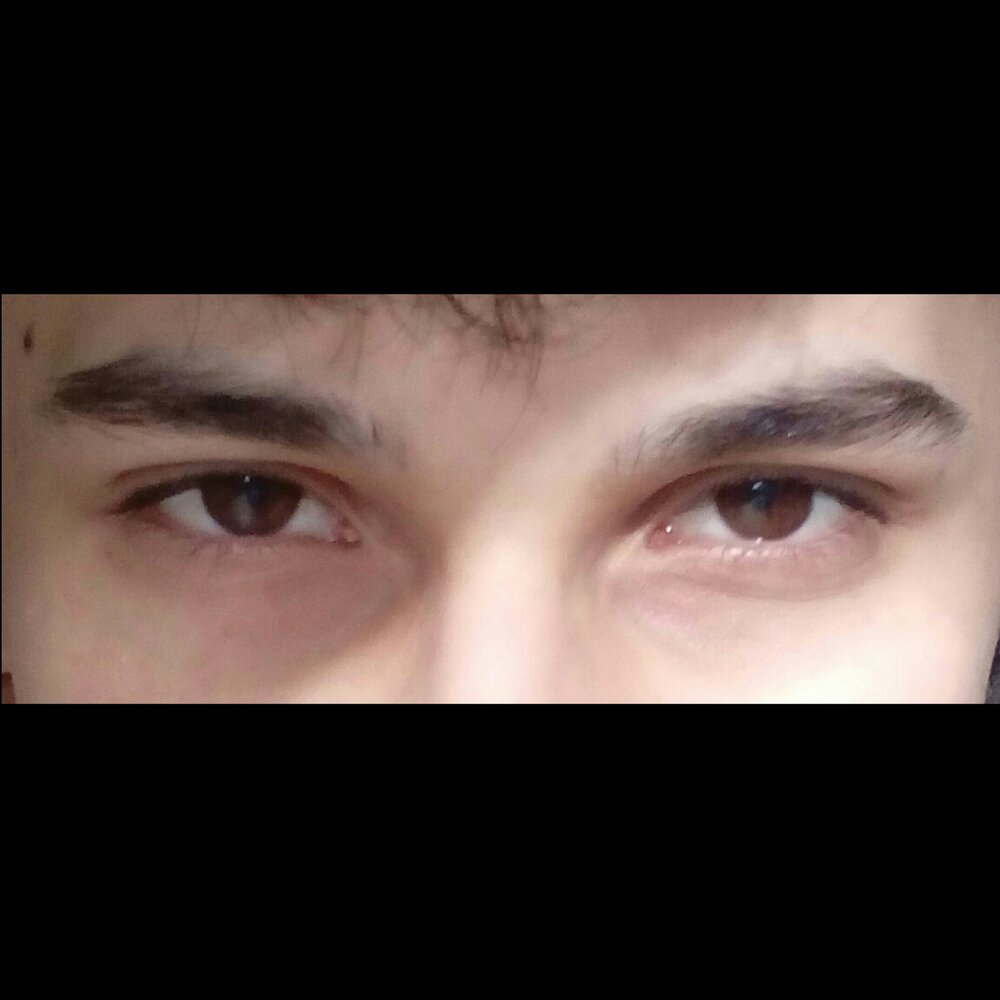 Shitty fag eyes