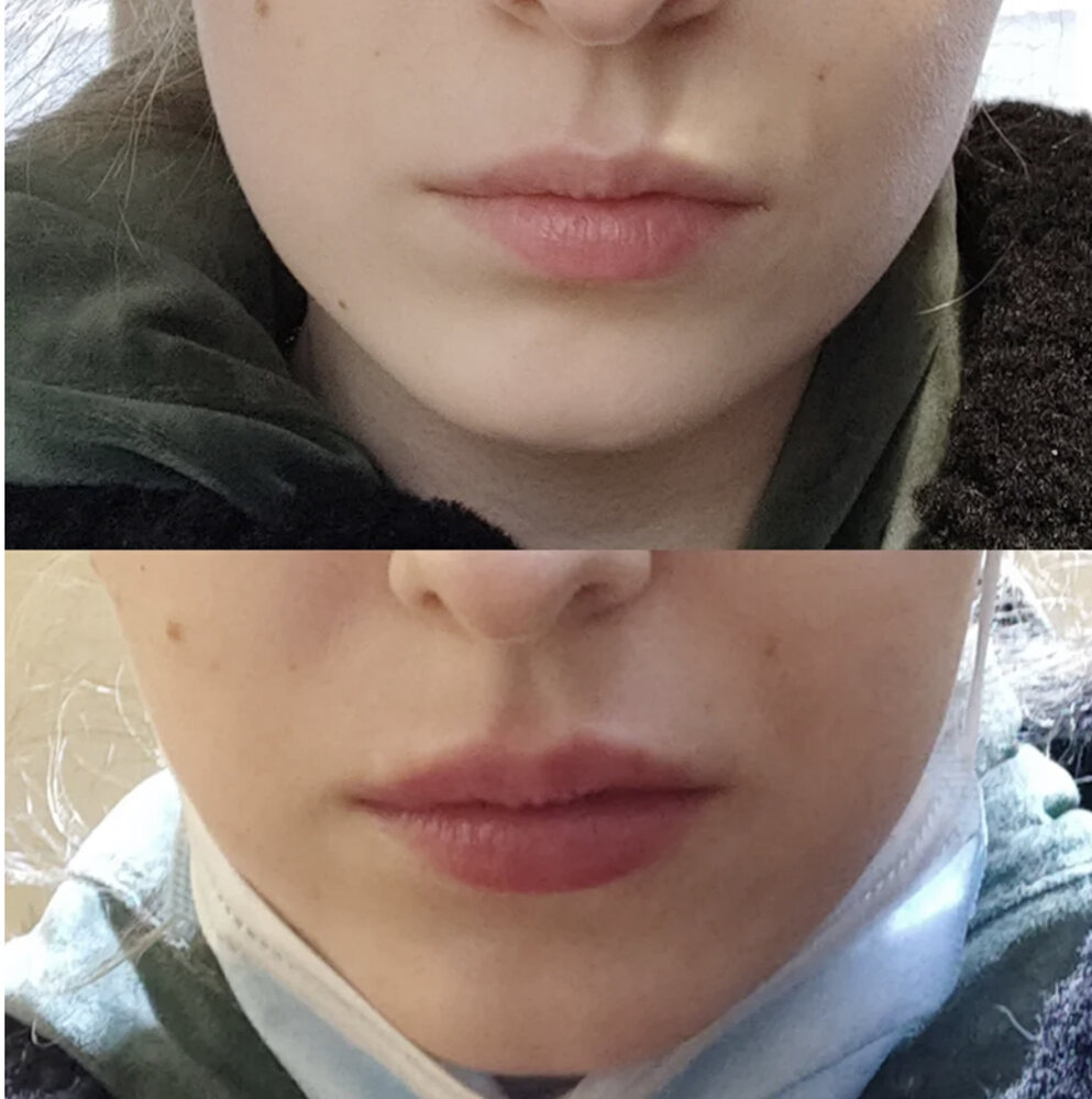 11F78956 281E 4B11 9619 85896F228556