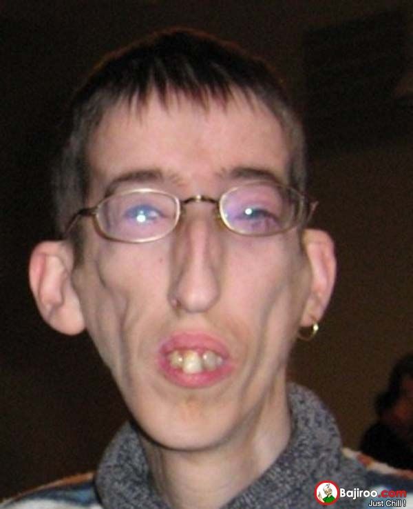 Ugly people pictures 2