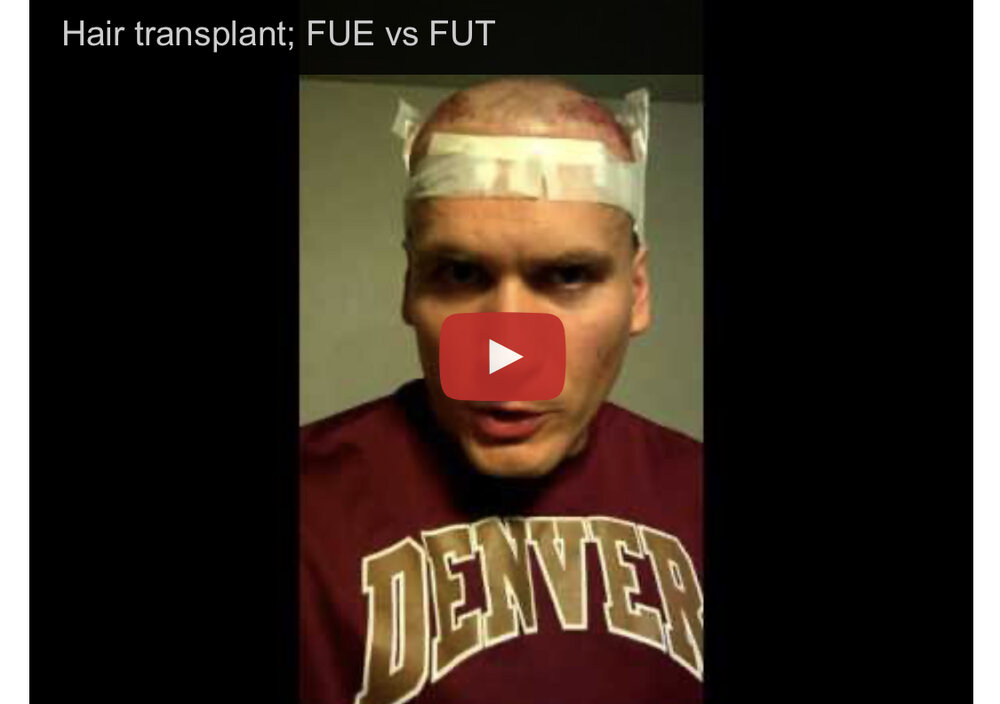 7DB236C7 B35F 4E4B BFC0 2A26056FD182