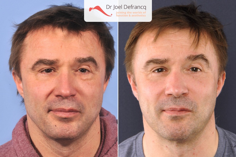 Dr Joel Defrancq 1536498117084992200 5718