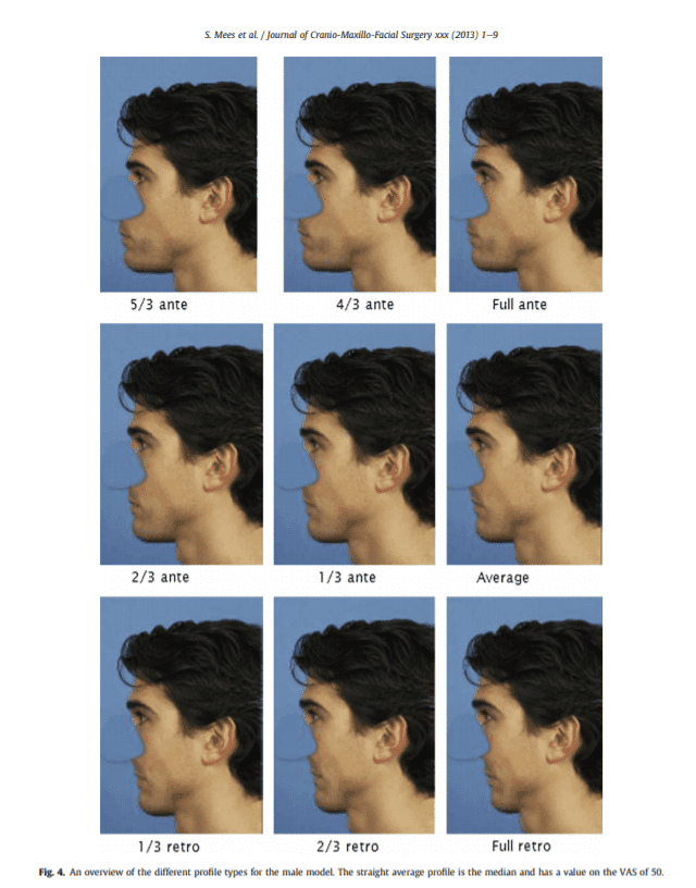 215409E8 7ED7 43E2 8E05 B8B429443591