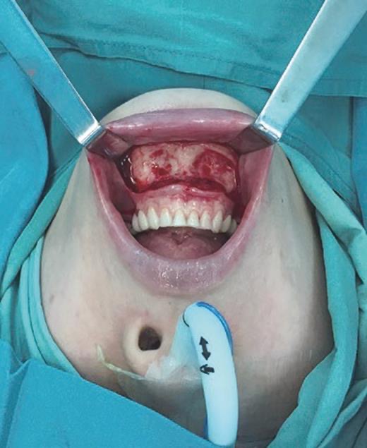 16CFEB1A 8B4B 4E64 970D 7C574B7FAA39