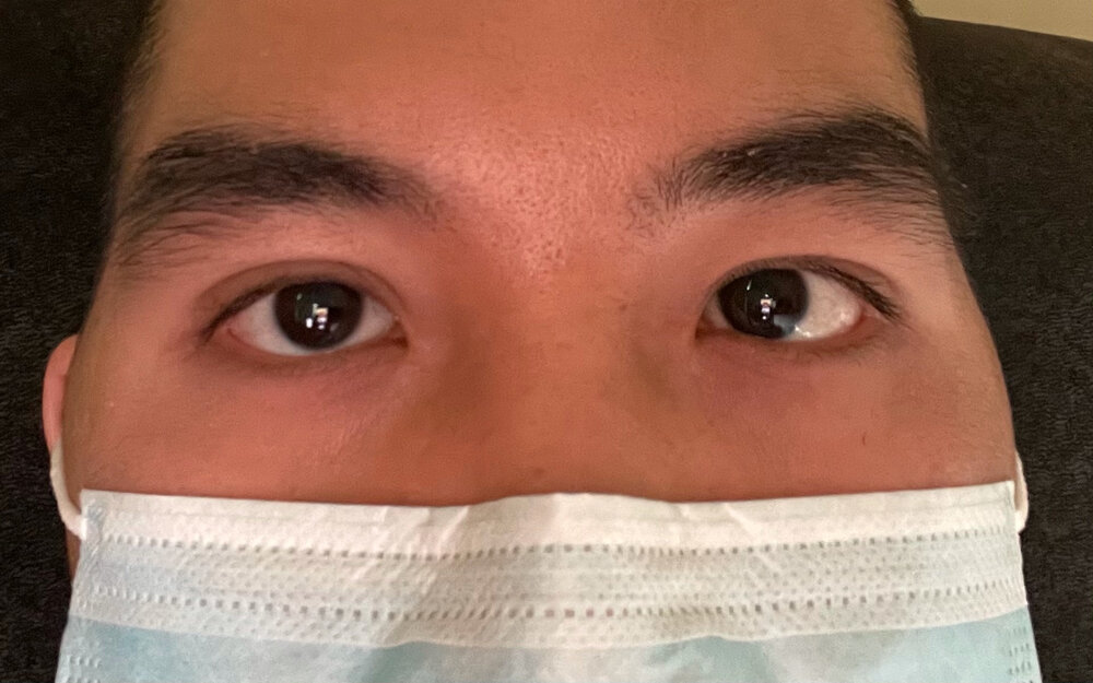 Eye