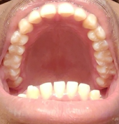 Snapchat 1304356792  01  01