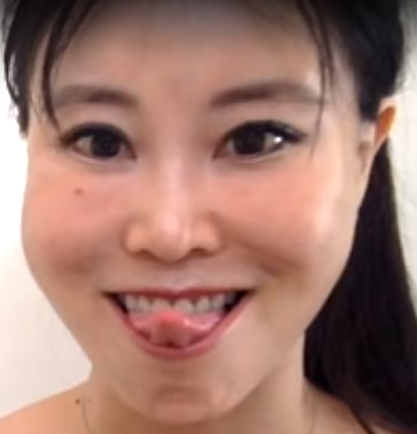 Xd