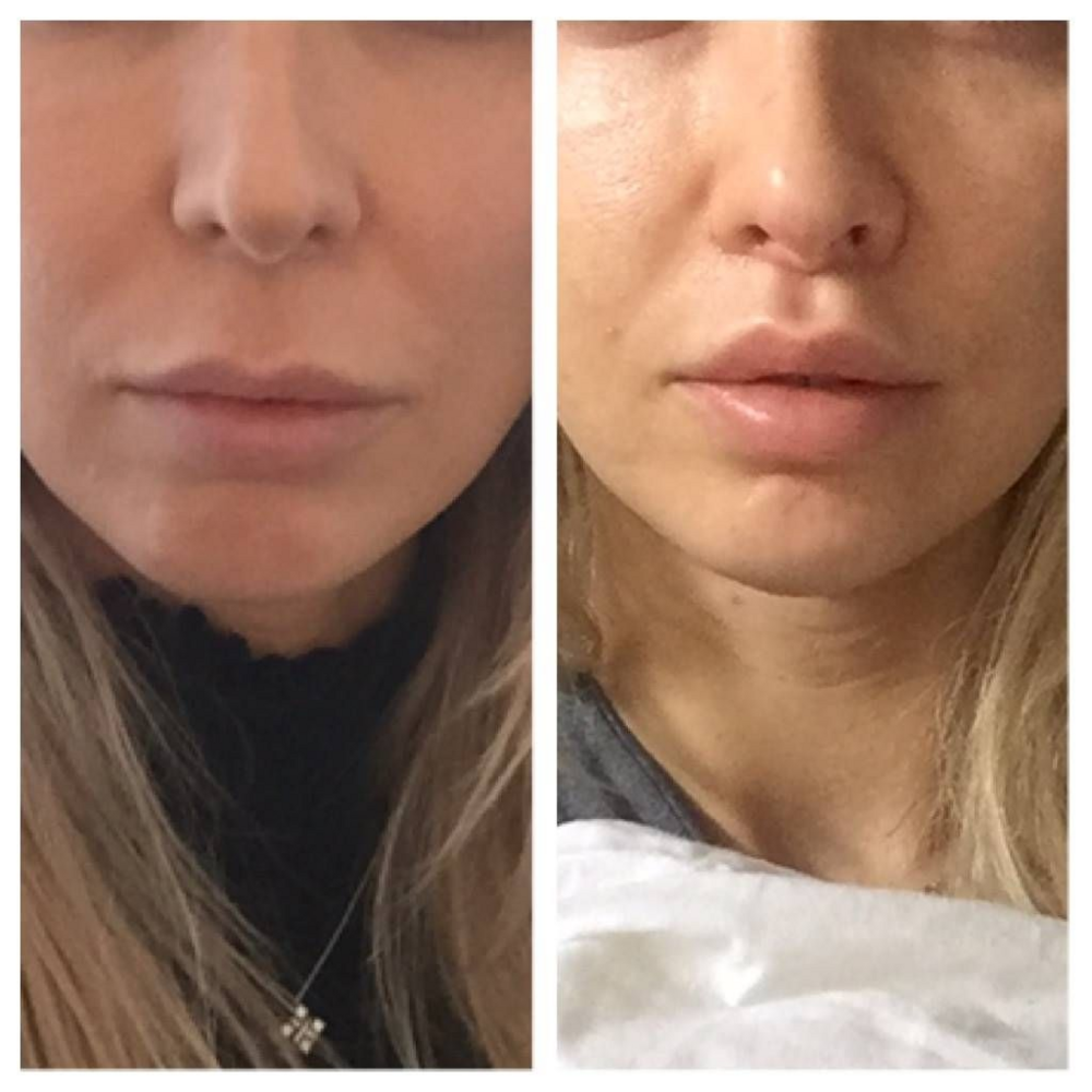 568CE353 710D 4059 A532 756CF910909E