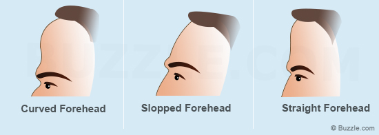 Forehead types