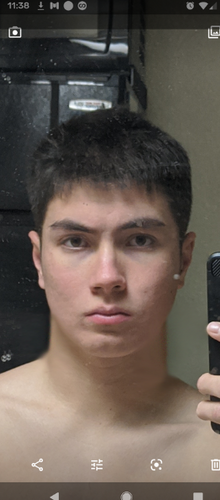maxille.png