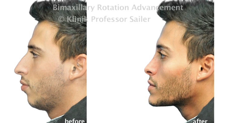 6B0E003B 95F3 4AA2 AB24 99418C6AADB3