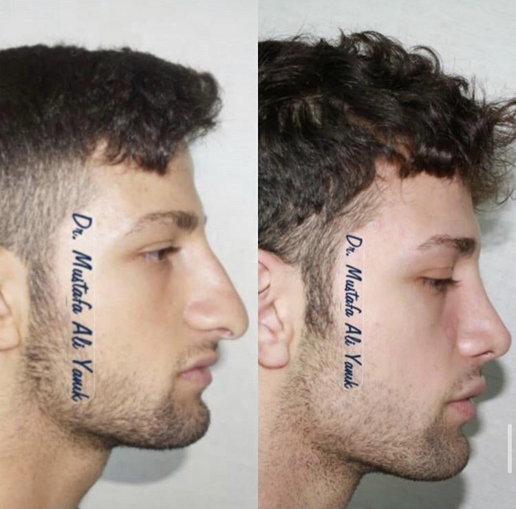 52898BC5 7074 4799 862D 577BA0FA23D3