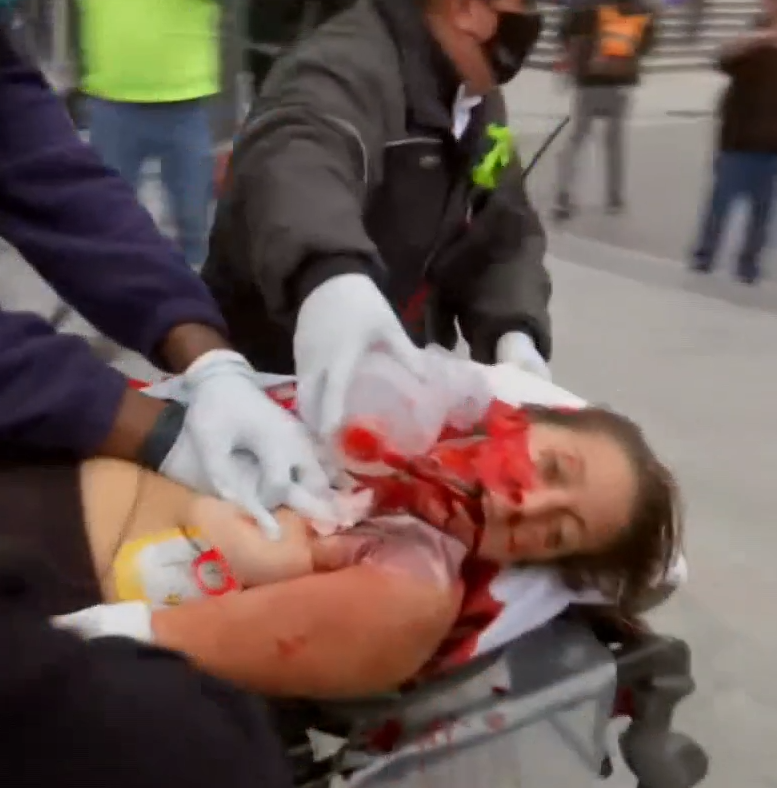 B3046544f1b306c0e26519d931ebd9ca654300508d1c33f8418d3471f1652024