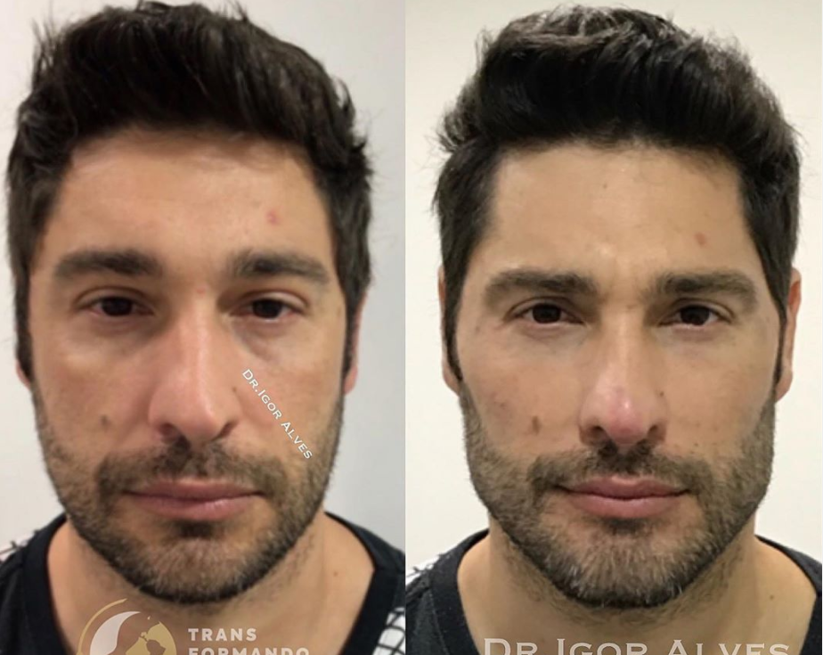 7285059 2063965305 dr3p