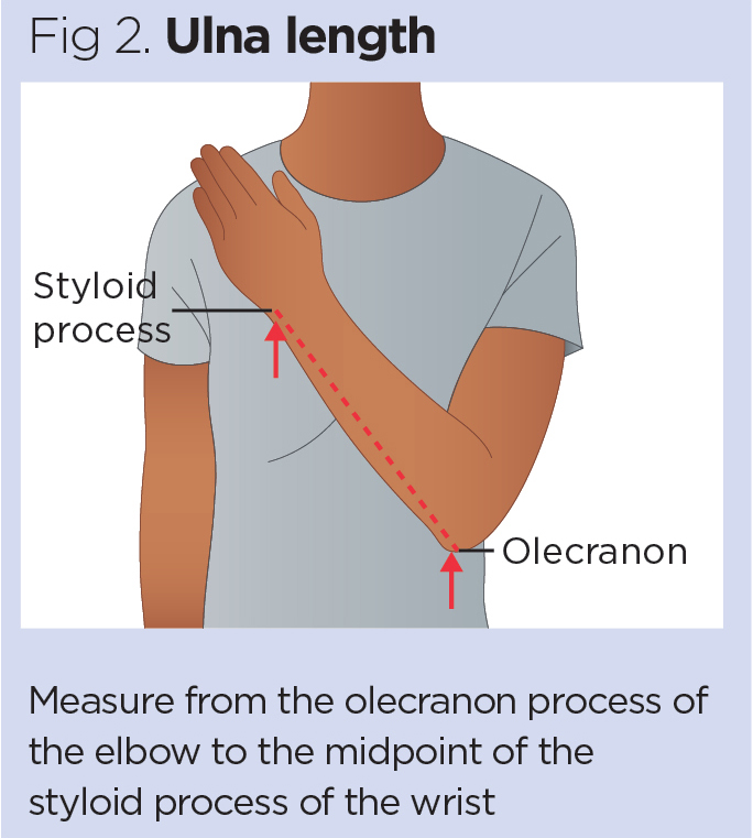 Fig 2 Ulna length