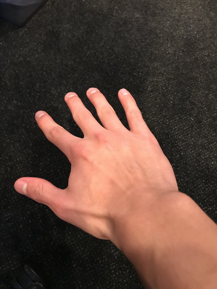 IMG 2735