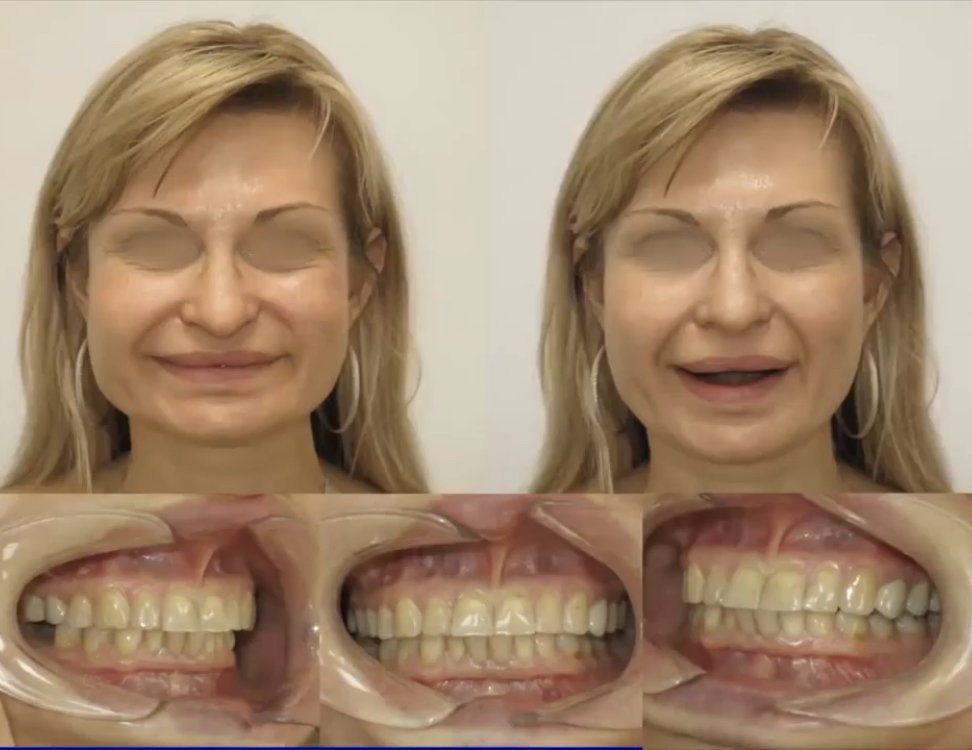 BE2A2B85 0DCA 4DC1 B887 7341BEC56ACA