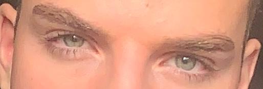 Eye