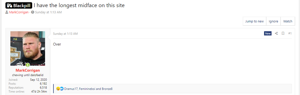 LongestMidfaceOnLooksmax