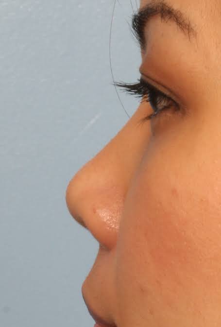 422780EE D73E 4114 BEC2 55DA817A2BF8