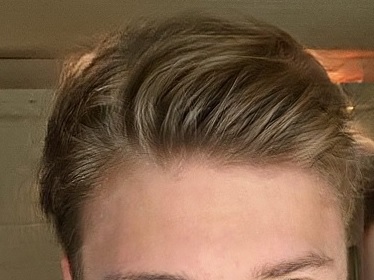 Hair best