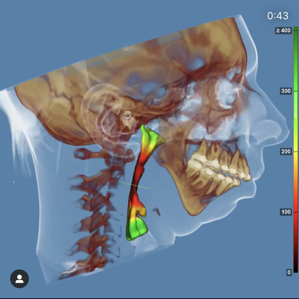 3F75F750 B9E7 4BED B842 76CAC6FC9B5D