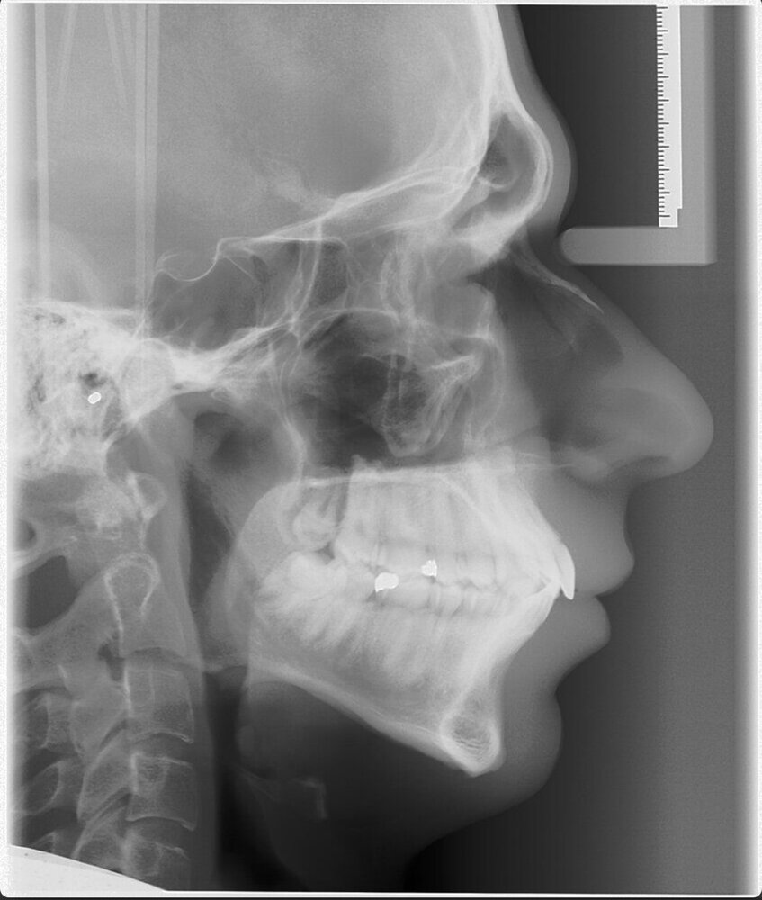 BF84426D A54F 4393 8B3F 272571EE7179