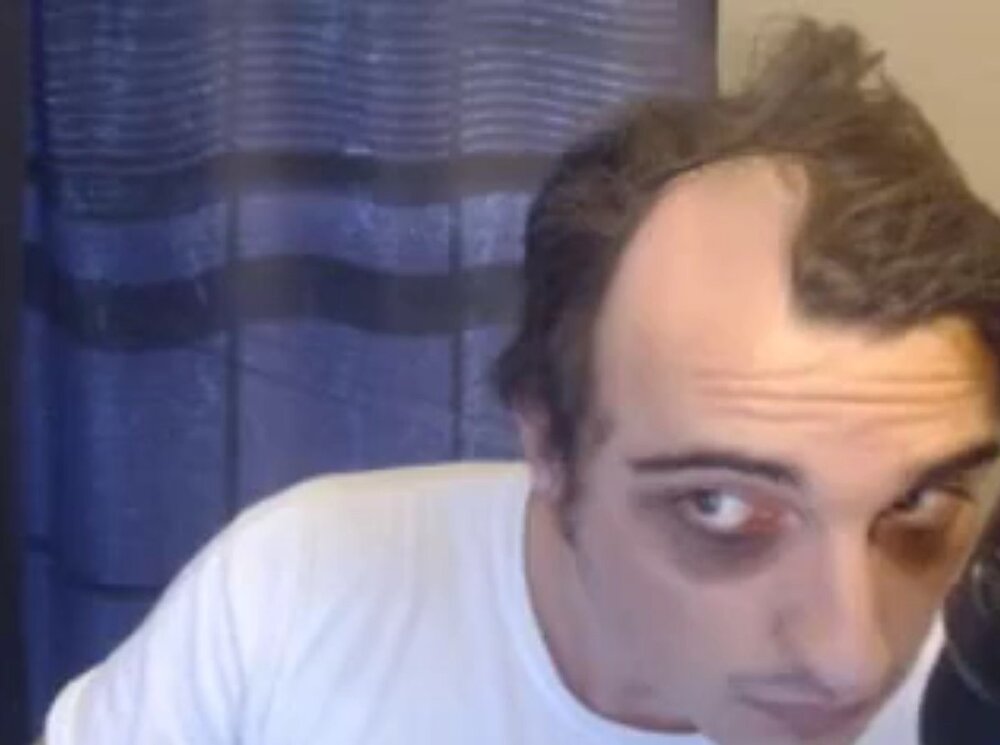1200px Man with racoon eyes
