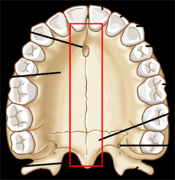 Palate
