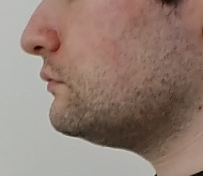 cazzo1.png