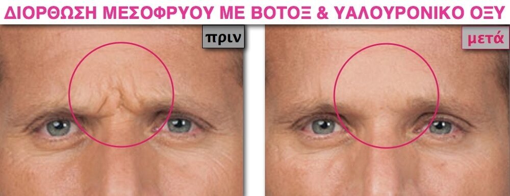 SITE DIORTHOSI MESOFRYOU09