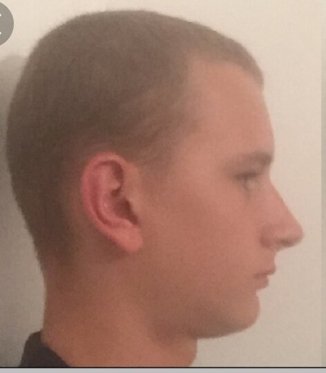 The 3 different side profiles (POLL) | Looksmax - Men's Self ...