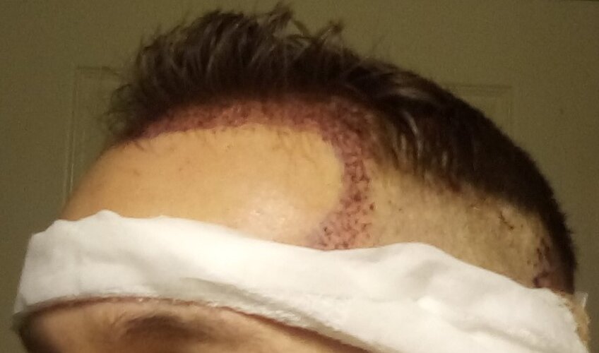 hair.jpg