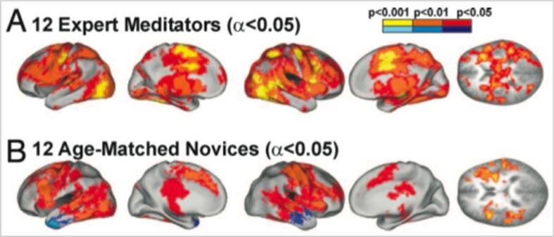 Brain meditation