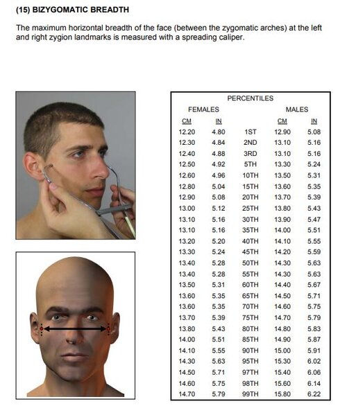 bizygomatic2.JPG