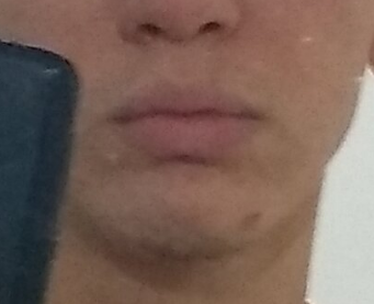 Lips