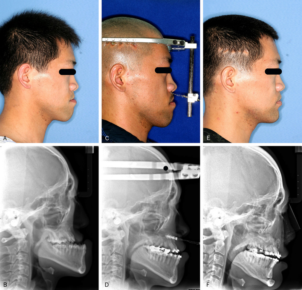 1A2B1E25 540E 470B B4D9 F55C32A3FC80