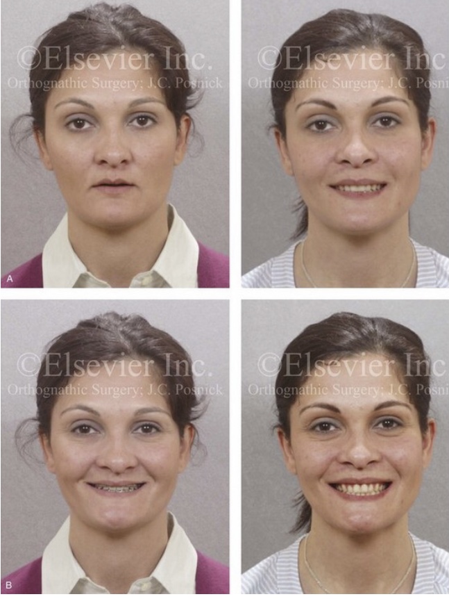 948DD5A4 E835 4812 BC93 2F29613CD944