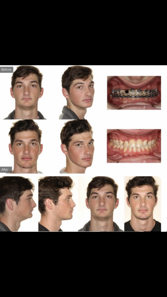 17D894FF 3DA4 410E BAE7 91A04E53A5DC