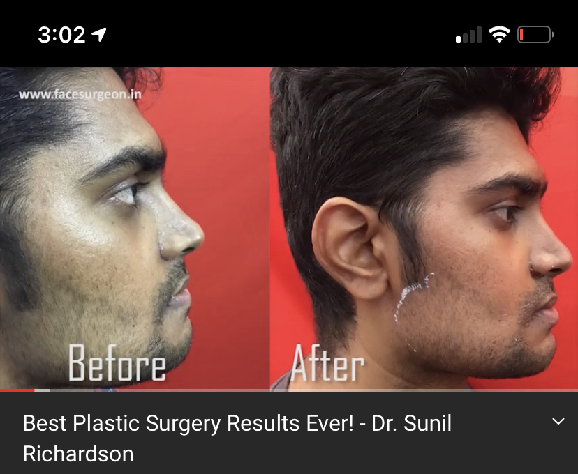 DA0D30CE 2987 49CD 97F5 D23439EB803A